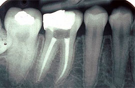 service-root-canal